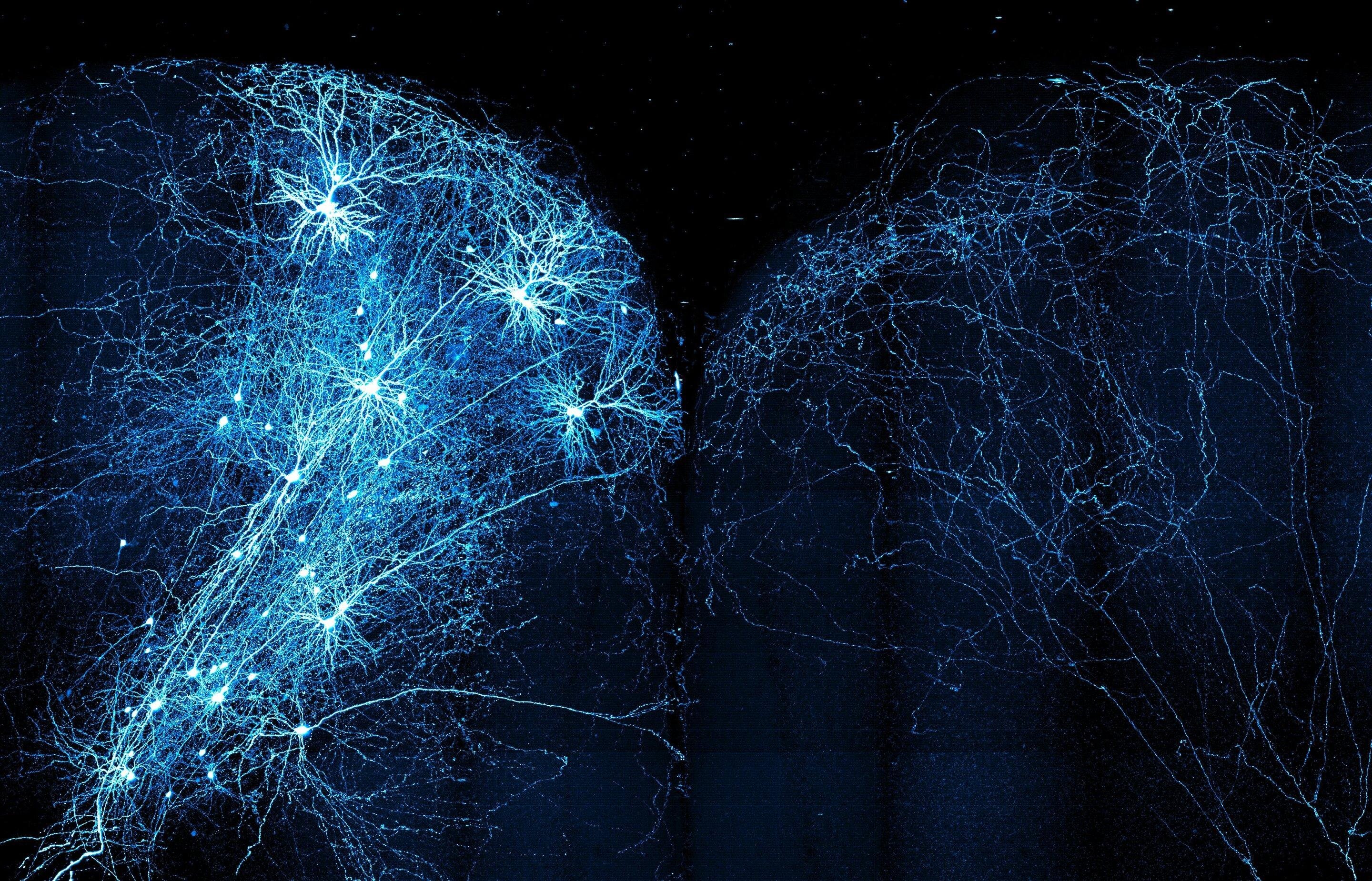 Brain neurons. Нейрон в нейронной сети. Нейросеть Нейроны мозг. Нейронная сеть арт. Yейронные связи.