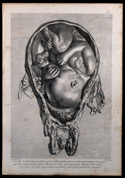 Эмбрион арт (66 фото)