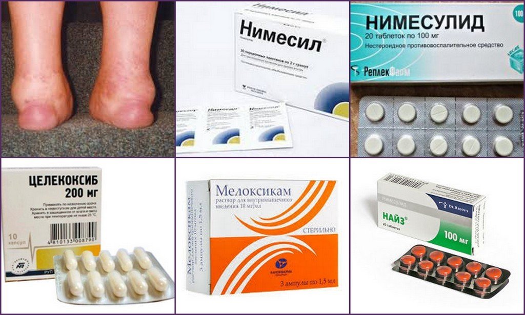 Отеки ног лечение лекарства и препараты