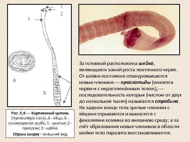 Членики ленточного червя. Карликовый цепень (Hymenolepis Nana). Половозрелая особь карликового цепня. Карликовый цепень проглоттиды. Карликовый цепень сколекс.
