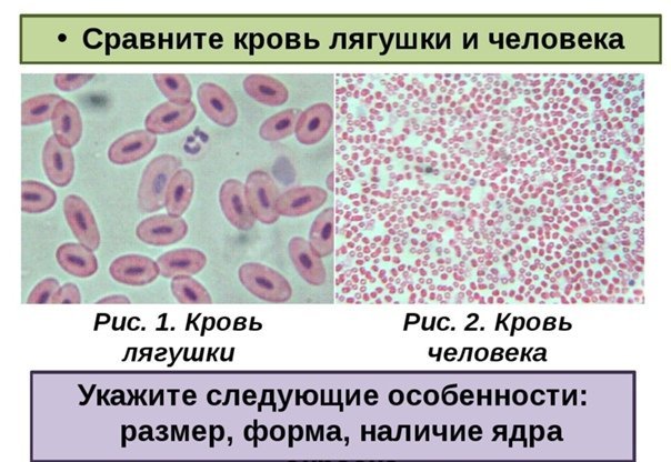 Исследование крови лягушки какая биологическая наука. Строение клетки крови человека и лягушки. Строение эритроцита крови лягушки. Строение эритроцитов лягушки рисунок. Клетки крови человека и лягушки под микроскопом.