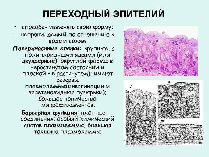 Слои переходного эпителия. Переходно клеточный эпителий. Эпителий мочевого пузыря гистология. Переходный эпителий грушевидные клетки. Функции многослойного переходного эпителия.