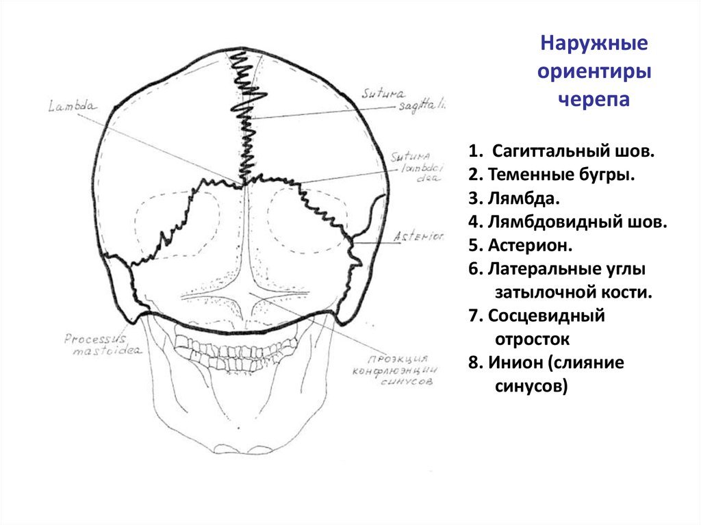 Соединение теменной кости и затылочной. Стреловидный шов черепа. Металлический шов черепа. Швы черепа человека рисунок с подписями. Сагиттальный шов черепа.