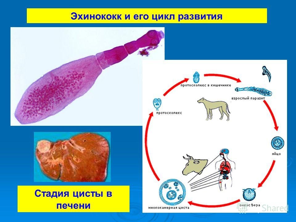 Чем опасен эхинококк для человека. Эхинококк это плоские черви. Плоский червь эхинококк. Эхинококк приспособление к паразитическому образу жизни.