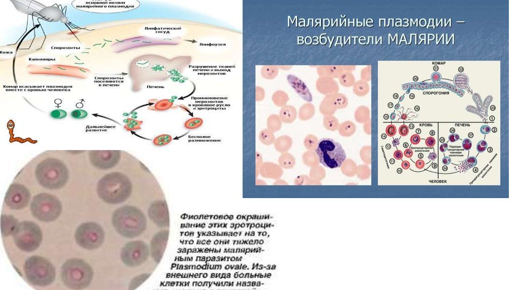 Несколько ведущих генераций плазмодиев в патогенезе малярии. Малярийный плазмодий. Малярийный плазмодий трансмиссивное. Малярийный плазмодий это бактерия. Малярийный плазмодий вызывает заболевание.