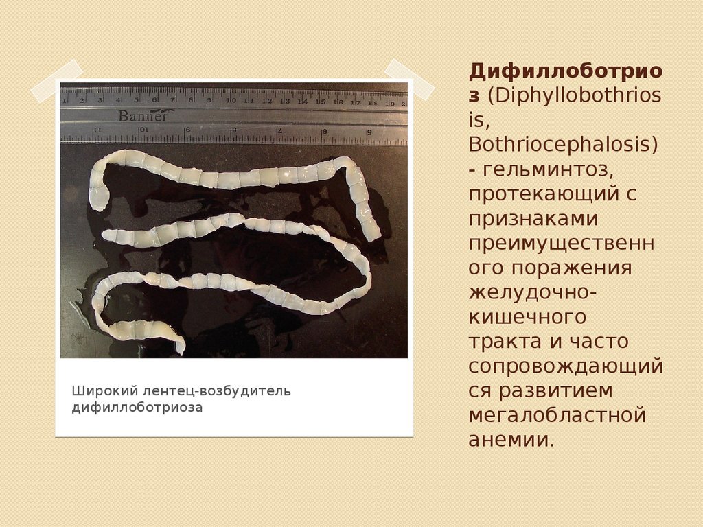 Цепни на латыни. Ленточный червь лентец. Ленточные черви широкий лентец. Чаечный дифиллоботриоз. Широкий лентец /Diphyllobothrium.