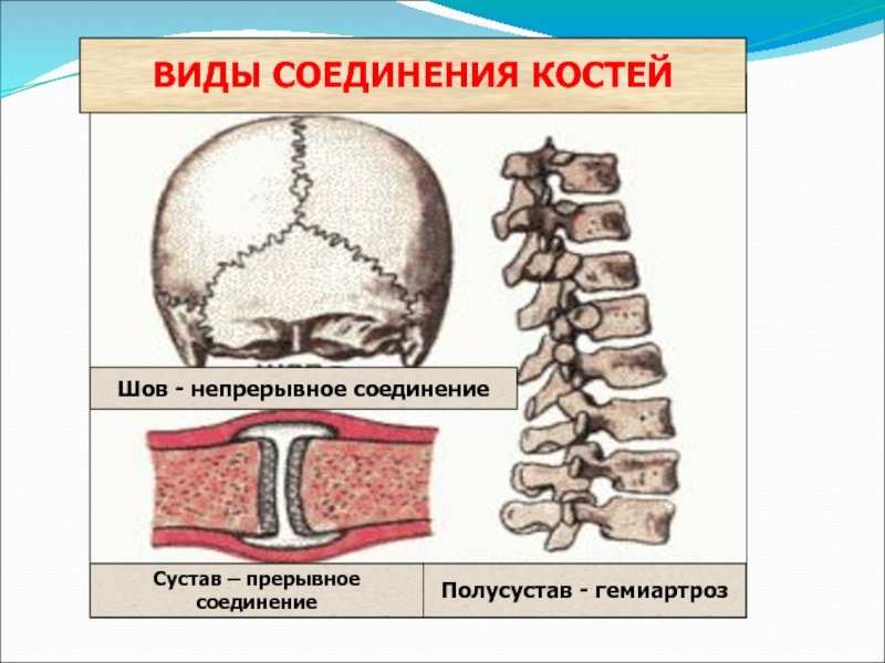 Способы соединения кости. Прерывные и непрерывные соединения костей. Типы соединения костей. Неподвижное соединение костей. Типы соединения костей полуподвижные.