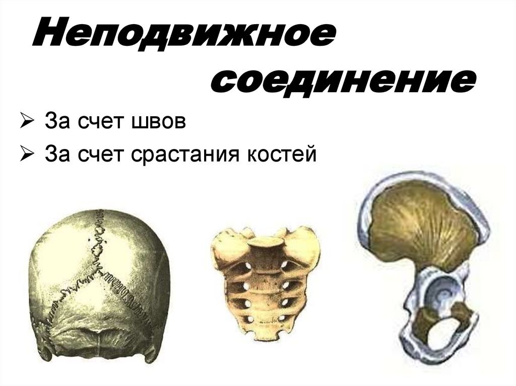 Примеры полуподвижных соединений. Подвижное полуподвижное и неподвижное соединение костей. Полуподвижное соединение костей. Неподвижное соединение костей. Кости с неподвижным соединением.