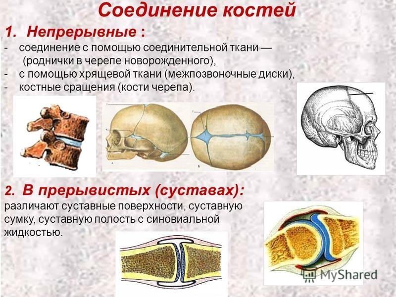 Кости черепа соединяются с помощью