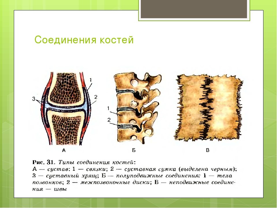 Основные соединения костей. Непрерывные фиброзные соединения костей рисунок. Классификация соединений костей схема. Типы соединения костей схема. Схема виды соединения костей в скелете человека.