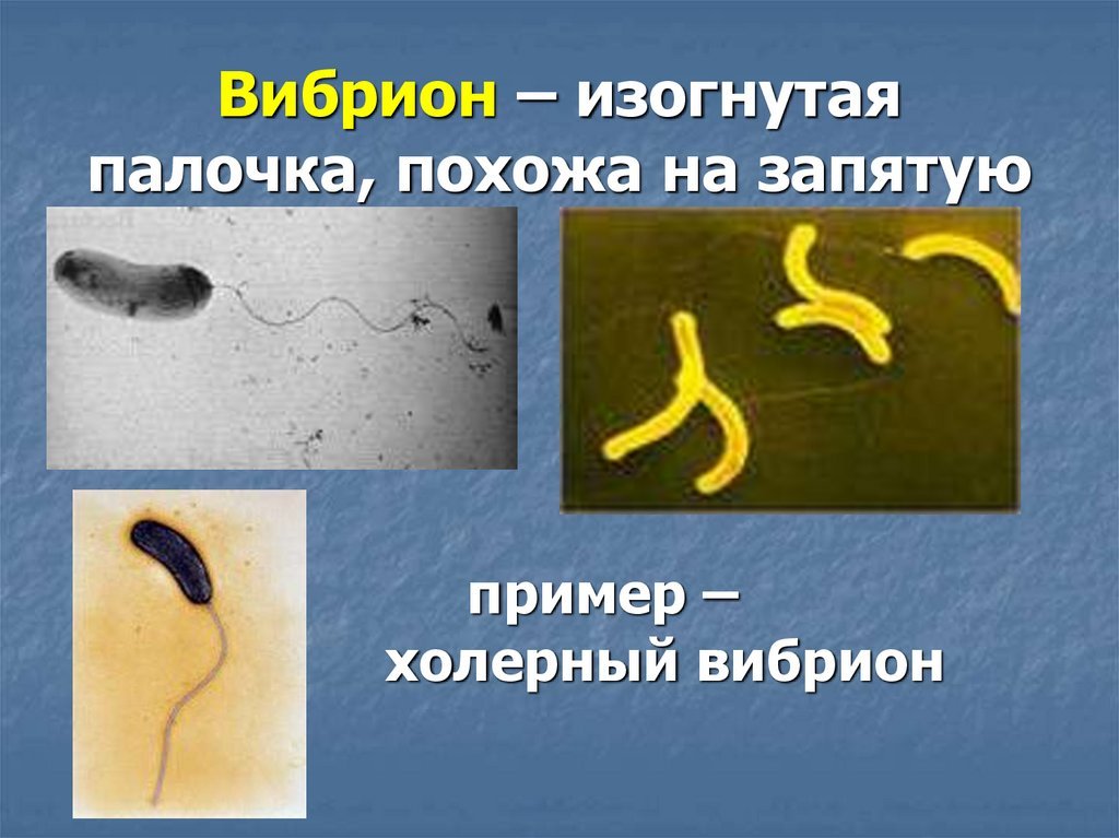 Бактерии изогнутой формы носят название. Вибрионы и спирохеты. Вибрионы и спириллы. Форма бактерии вибрионы. Извитыми (вибрионы, спириллы, спирохеты).