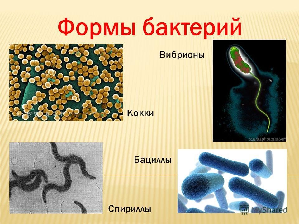 Пару бактерий. Форма бактерии бациллы вибрионы. Бактерии кокки бациллы вибрионы. Кокки бациллы вибрионы спириллы. Формы бактерий кокки бациллы спириллы вибрионы.