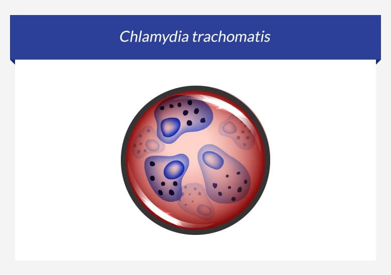 Anti chlamydia trachomatis. Хламидия микробиология морфология.