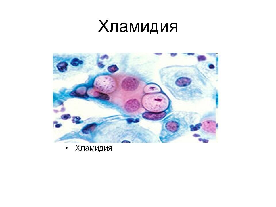 День хламидии. Хламидии микробиология. Хламидии урогенитального хламидиоза. Хламидии препарат микробиология.
