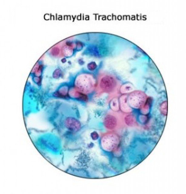 Хламидия trachomatis