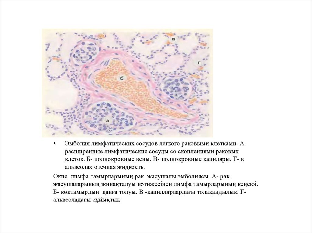 Лимфатические сосуды клетки