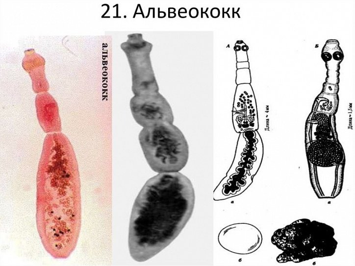 Эхинококк и альвеококк микроскоп