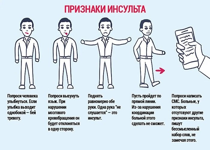 Симптомы инсульта картинки