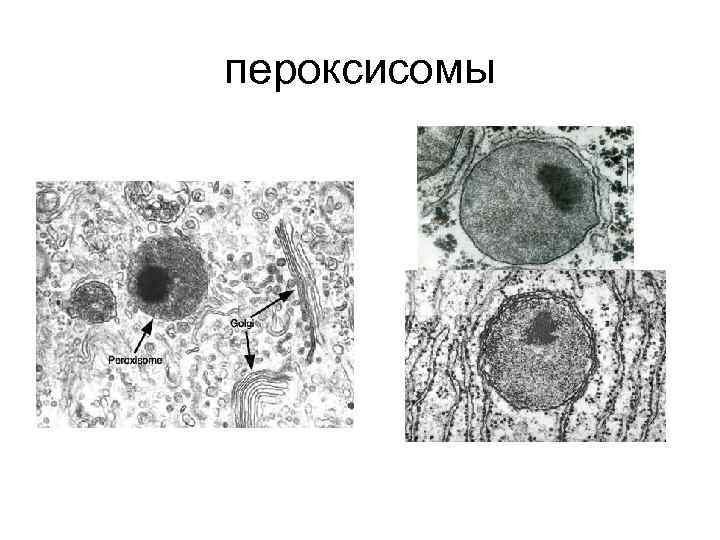 Пероксисомы в растительной клетке