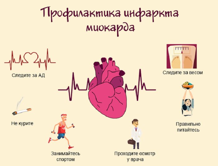 Вторичная профилактика инфаркта миокарда памятка