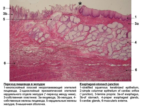 Переход пищевода в желудок препарат гистология