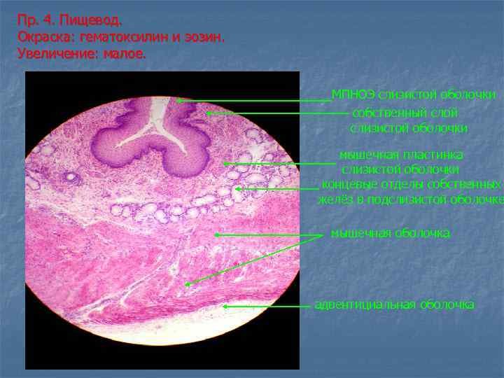 Пищевод окраска гематоксилин-эозином