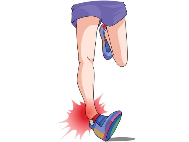 Girl Sprained her Ankle