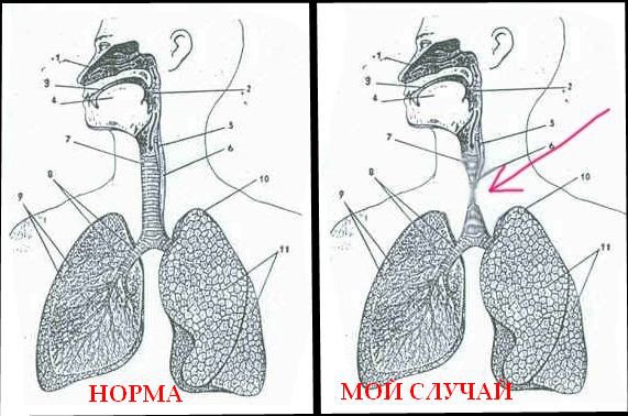 Легкие с обозначениями
