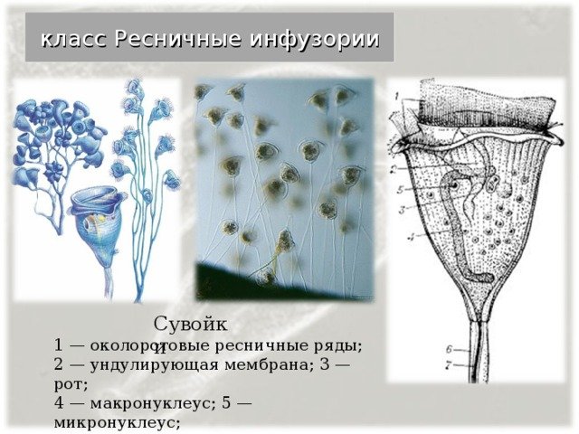 Фортицелла инфузория