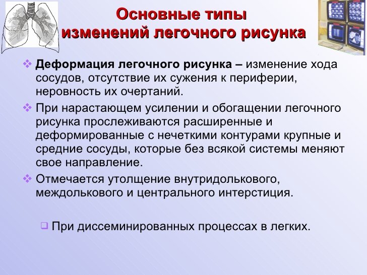 Легочный рисунок деформирован