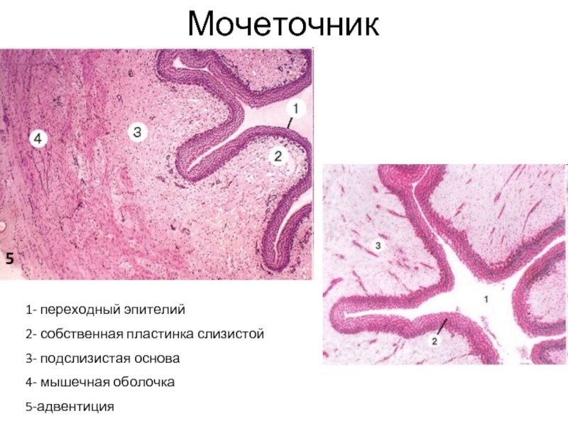 Мочеточник гистология препарат
