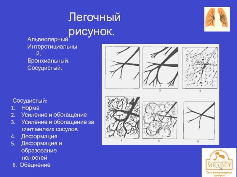 Усиление сосудистого рисунка