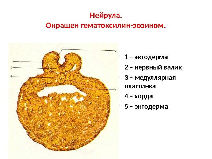 Зародыш нейрула