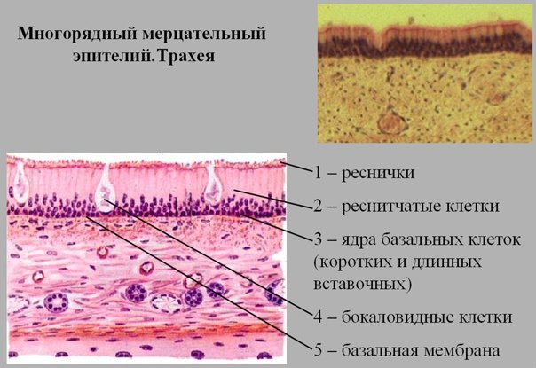 Многорядный призматический мерцательный эпителий трахеи