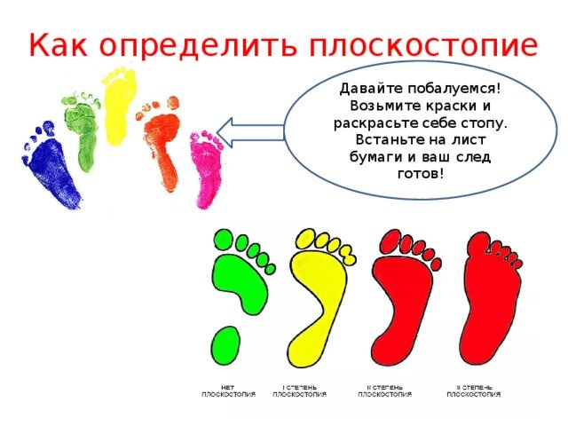 Плоскостопие как определить в домашних условиях