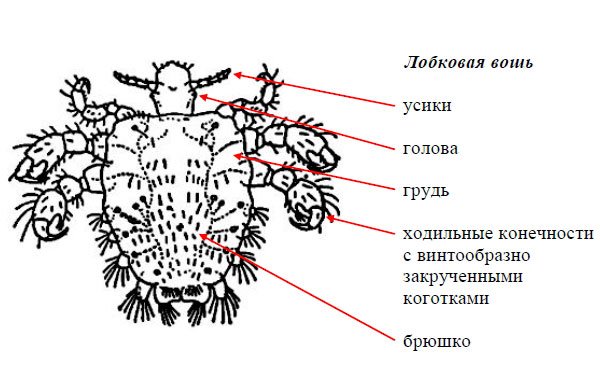 Головная вша строение