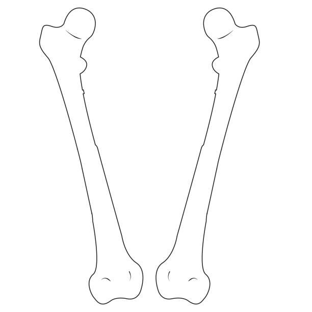 Рисунок бедренной кости