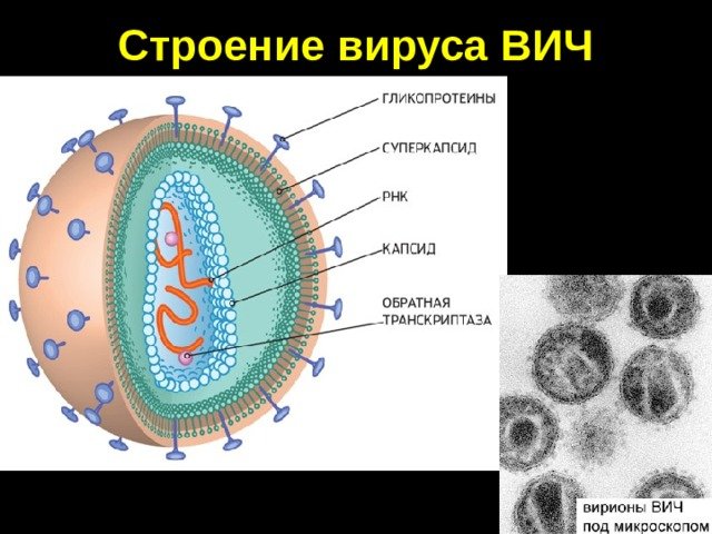 Строение клетки СПИДА