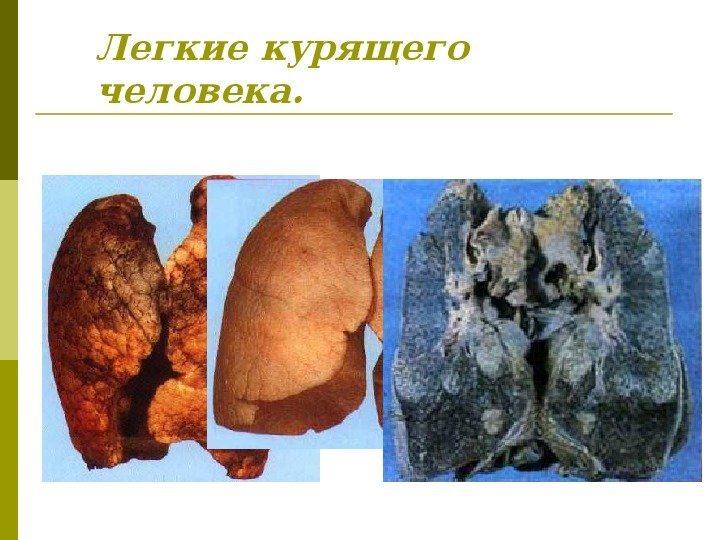Легкие курящего человека