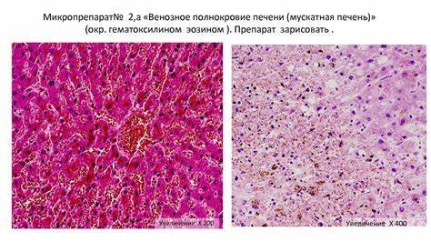Мускатная печень