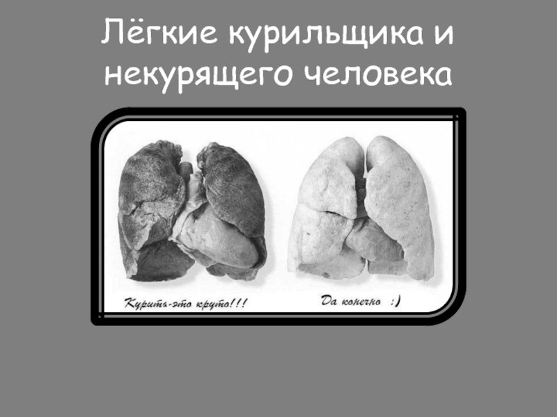 Лёгкие курящего человека