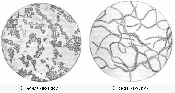 Рисунок стафилококка под микроскопом