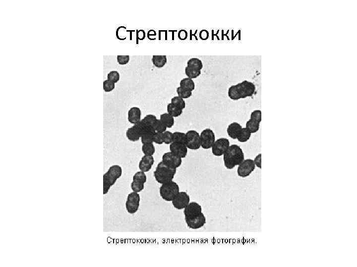 Диплококки стрептококки стафилококки