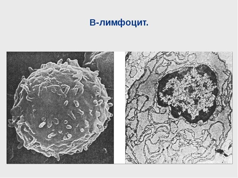 B лимфоциты строение