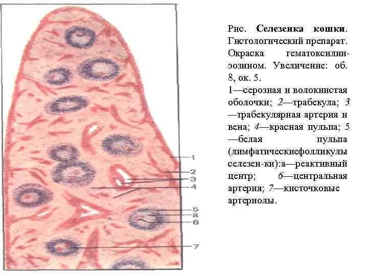 Селезенка гистологический препарат