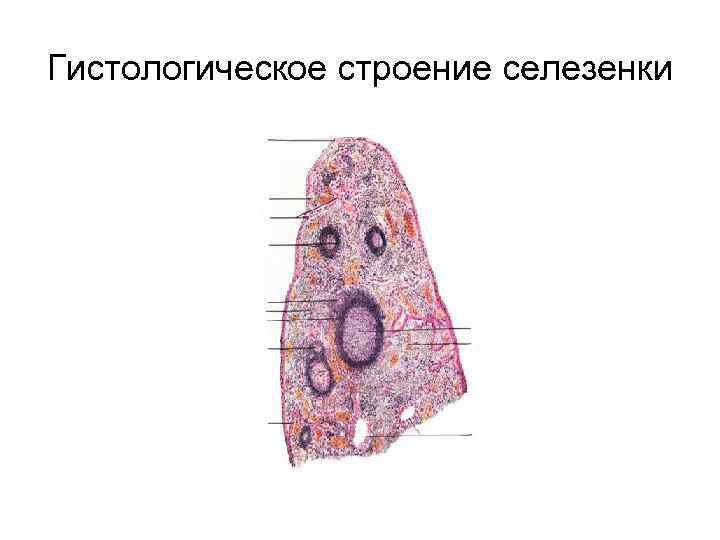 Селезенка препарат гистология с обозначениями