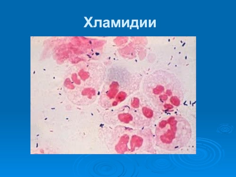 Романовский Гимза окраска хламидии