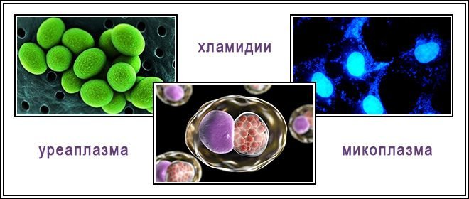 Хламидии микоплазма уреаплазма