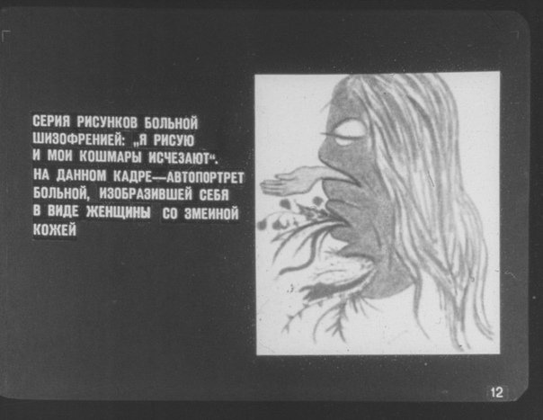 Больных шизофренией