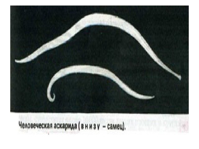 Человеческая аскарида